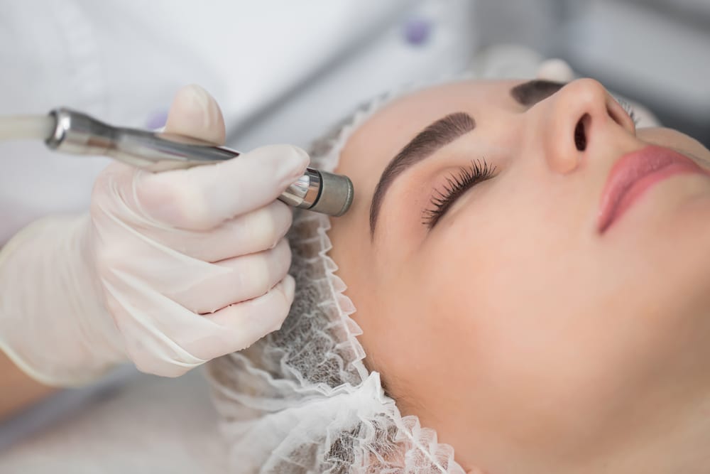 Microdermabrasion in Barrie